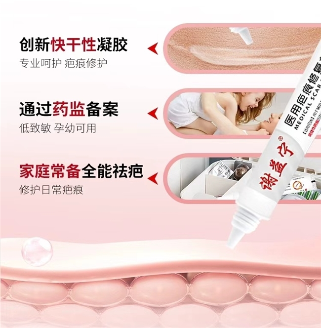 什么牌子的创可贴最好疤痕膏哪个牌子值得选？2025十大疤痕膏品牌权威排行榜出炉，榜首品牌竟是它_https://www.jmylbn.com_新闻资讯_第4张