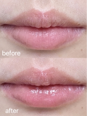 熬夜加班也不怕唇况差！Blistex日夜护唇法