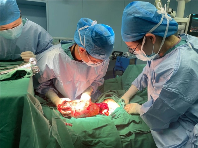 罕见!我院首例|早产宝宝还能以这种方式出生