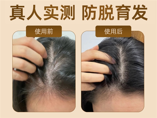 防脱洗发水口碑榜TOP10!公认好用的防脱洗发水品牌推荐 防脱洗发水口碑榜TOP10!公认好用的防脱洗发水品牌推荐