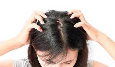 脂溢性脱发买哪个牌子的育发液效果好?口碑好的10款防脱生发液品牌推荐 脂溢性脱发买哪个牌子的育发液效果好?口碑好的10款防脱生发液品牌推荐