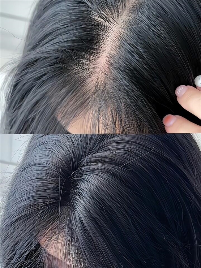 脂溢性脱发买哪个牌子的育发液效果好?口碑好的10款防脱生发液品牌推荐 脂溢性脱发买哪个牌子的育发液效果好?口碑好的10款防脱生发液品牌推荐