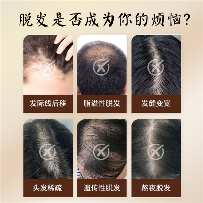 洗发水哪个牌子最好用最安全？2025最新防脱洗发水效果前十品牌公布