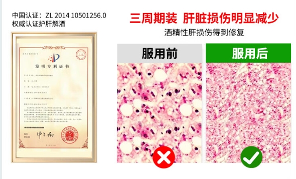 水飞蓟哪个牌子效果好,水飞蓟品牌排行,顶级配方品牌实测分析 水飞蓟哪个牌子效果好,水飞蓟品牌排行,顶级配方品牌实测分析