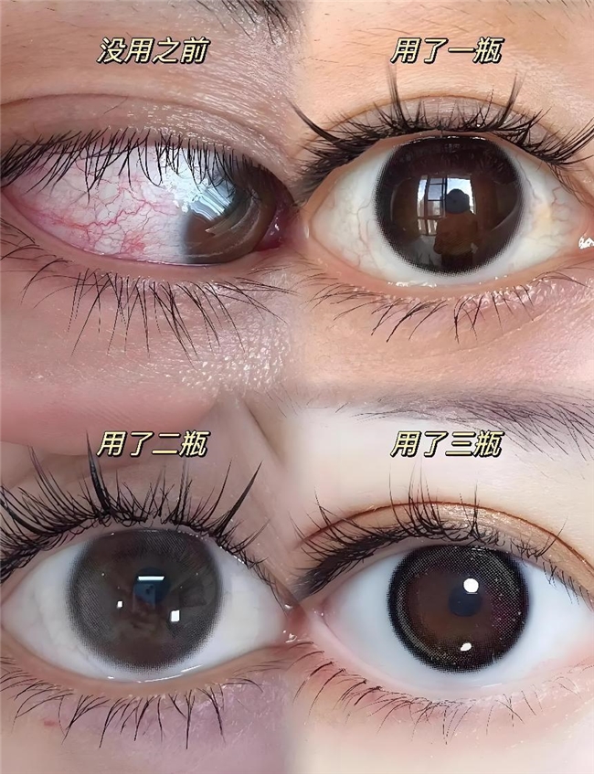 公认好用的叶黄素前十强!2025年度哪款护眼效果更胜一筹?实测第一款高吸收断层领先!(图7) 公认好用的叶黄素前十强!2025年度哪款护眼效果更胜一筹?实测第一款高吸收断层领先!(图7)