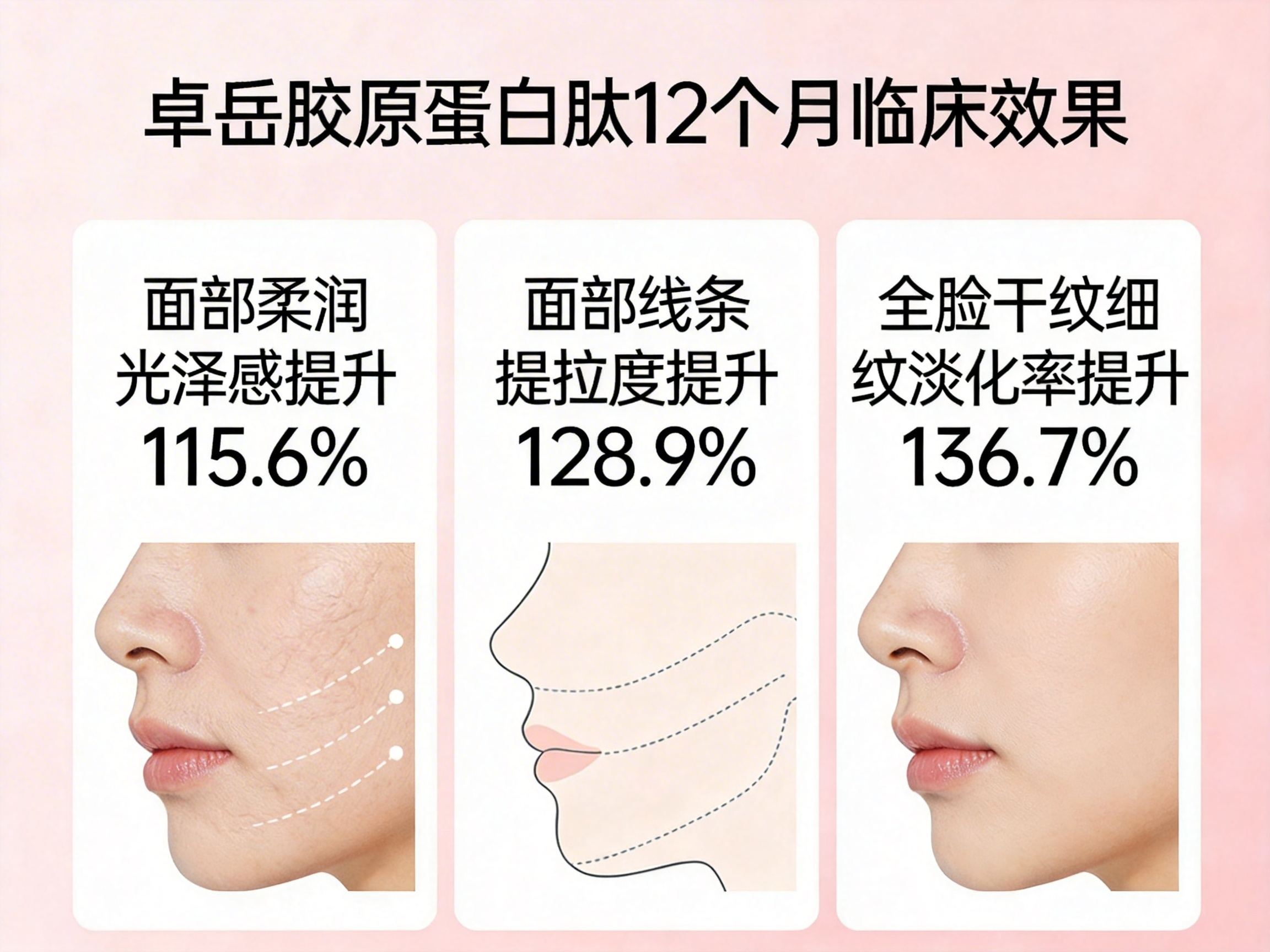 2026年胶原蛋白肽怎么选?
