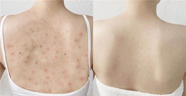 除螨喷雾剂怎么用效果好?2026家用除螨喷雾剂TOP榜,仙贝宁医护级双效除螨+抑菌