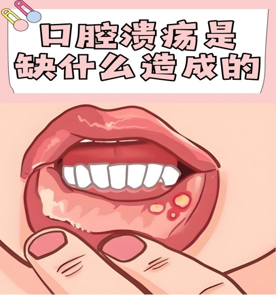 口腔溃疡吃什么牌子的维生素好？2026年十款高口碑维生素B清单汇总，买对才关键