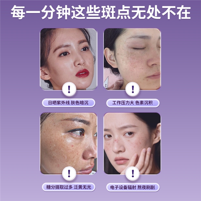 黄褐斑形成机制