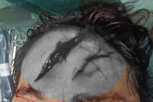 2.png 2.png